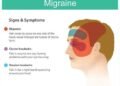 Migraine Symptoms