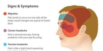 Migraine Symptoms